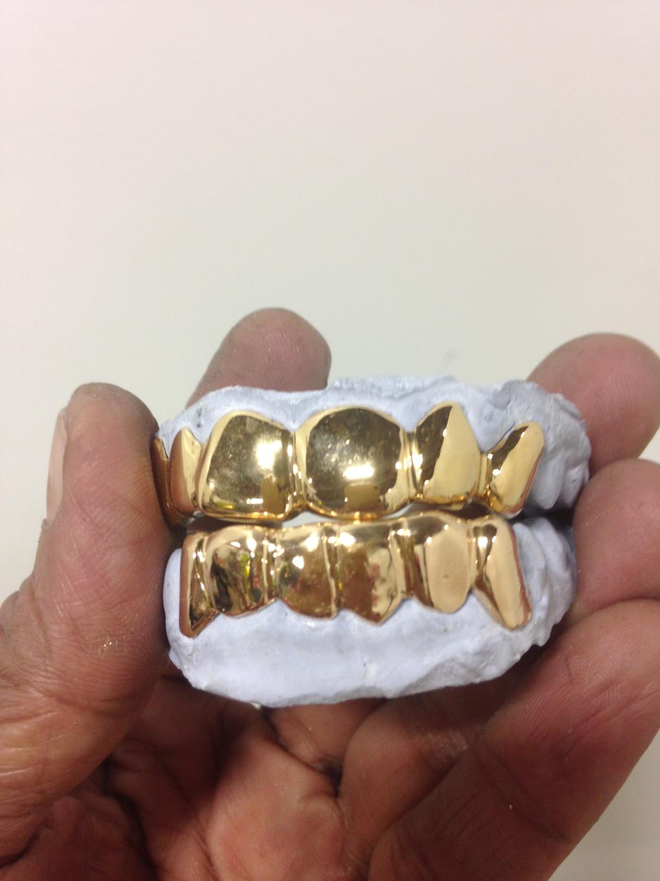 Custom Diamond Grillz
