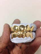 Custom Diamond Grillz