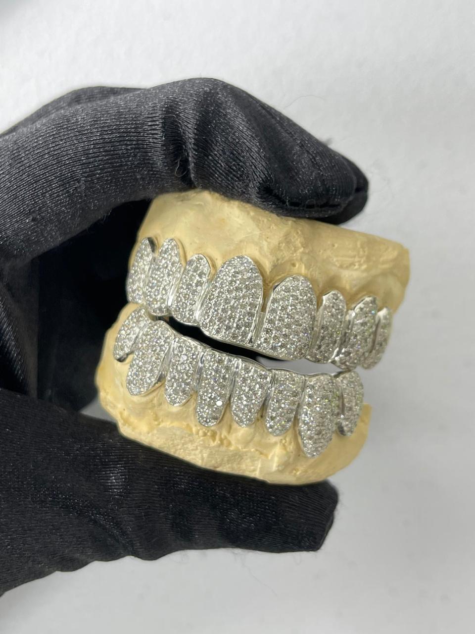 Custom Gold, Silver & Diamond Grillz