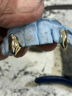 Custom Diamond Grillz