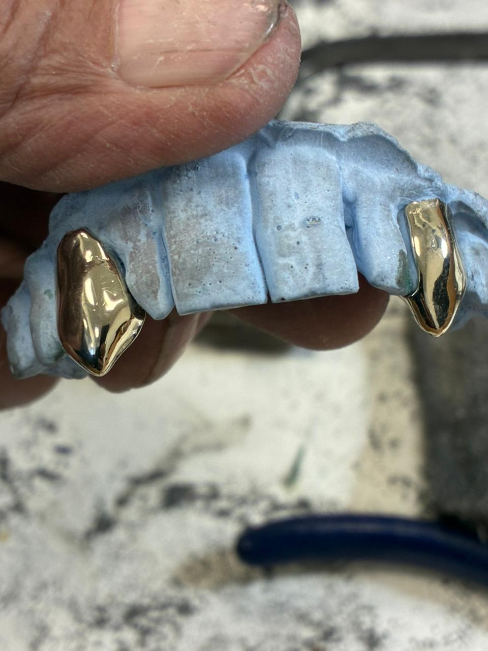 Custom Diamond Grillz
