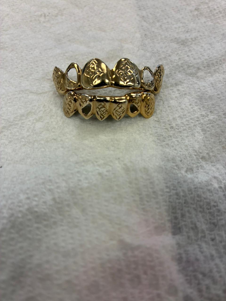 Custom Diamond Grillz