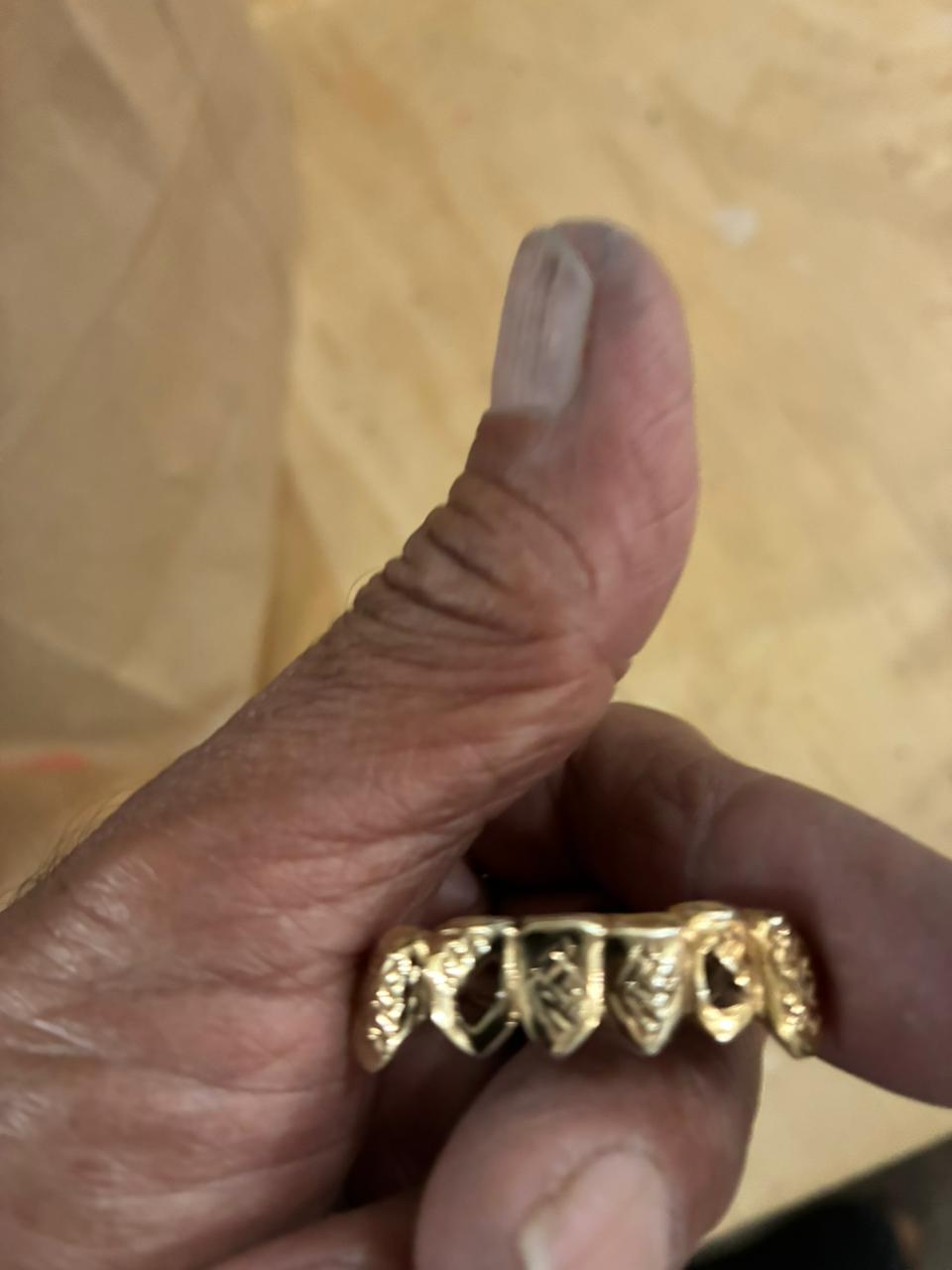 Custom Diamond Grillz